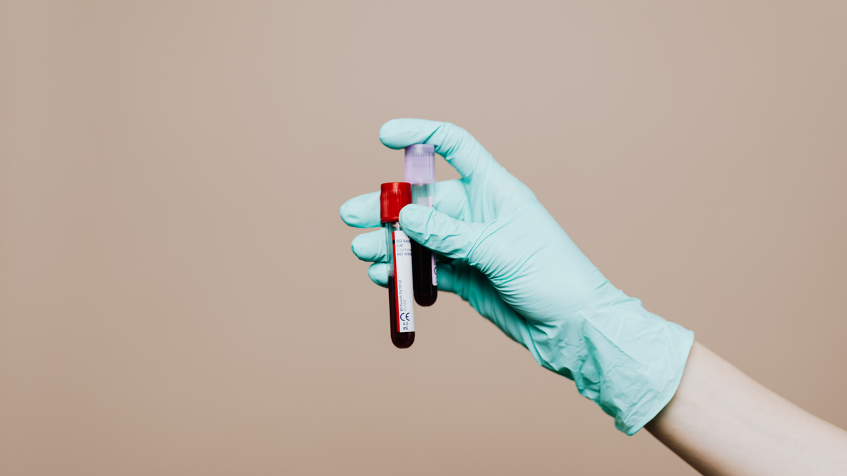 Cbd Testing Does CBD Show Up on A Drug Test? – CBD For Life