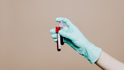 Does CBD Show Up on A Drug Test?